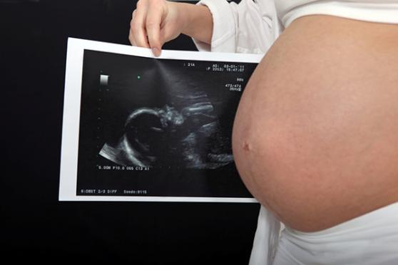 孕婦控管體重　增12至15公斤最適當