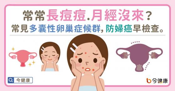 常常長痘痘、月經沒來？常見多囊性卵巢症候群，防婦癌早檢查。