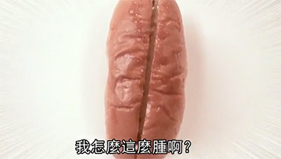 私密處腫