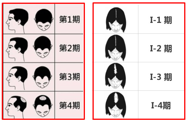 落髮