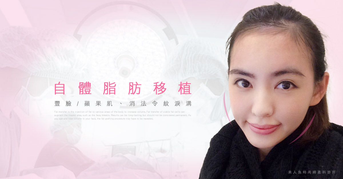 自體脂肪移植