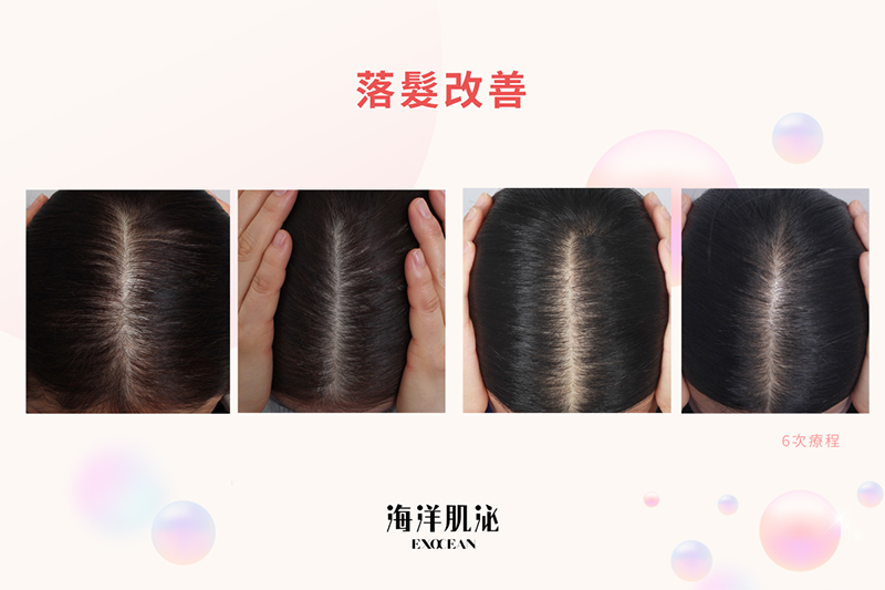 外泌體, 美人魚時尚婦產科診所, 私密處乾澀, 禿頭, 郭安妮, 高潮, 性生活